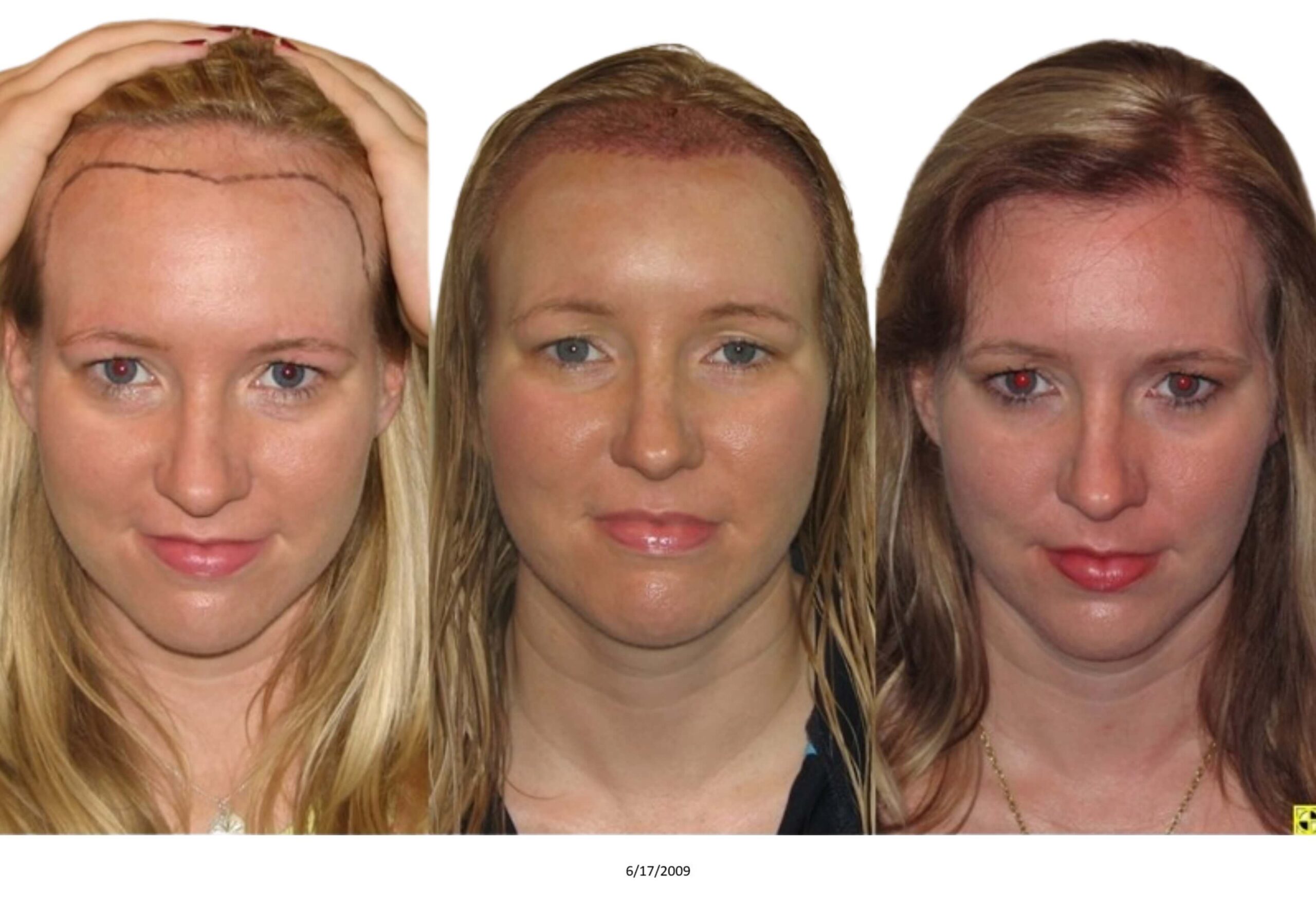 Female B&A_26_bw