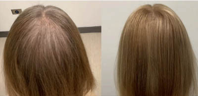 Alma-TED_before-after_p1 Alma TED before and after