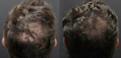 Alma-TED_before-after_p2 Alma TED before and after