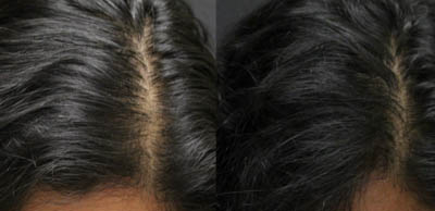Alma-TED_before-after_p3 Alma TED before and after