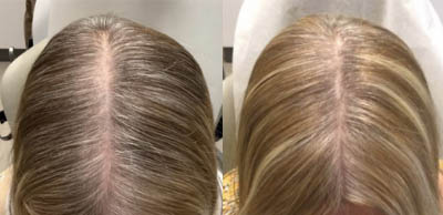 Alma-TED_before-after_p5 Alma TED before and after